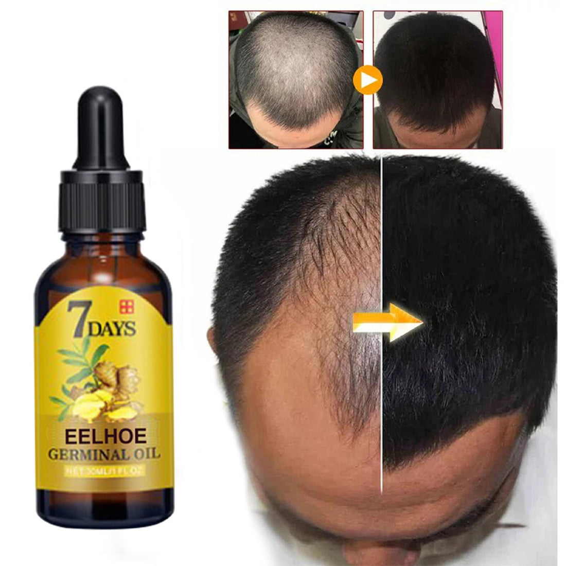 EELHOE Ginger Hair Care Solution For Hair Nourishing And Moisturizing Hair Care For Hair Stabilizing And Preventing Hair Loss